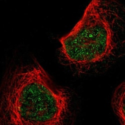 KLHL8 Antibody, Novus Biologicals 25 &mu;L; Unlabeled:Antibodies, Polyclonal